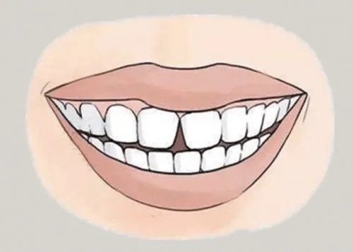 <a href=http://www.zbgn.cn/news_article?news_id=116>一次性口腔探針</a>